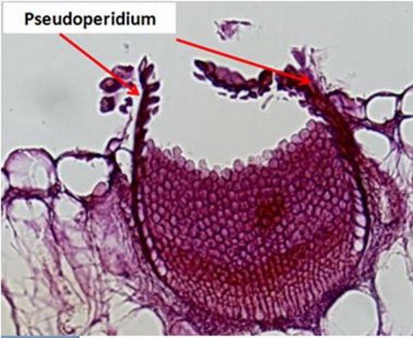 Pseudo-péridium (ou pseudo-péridie)