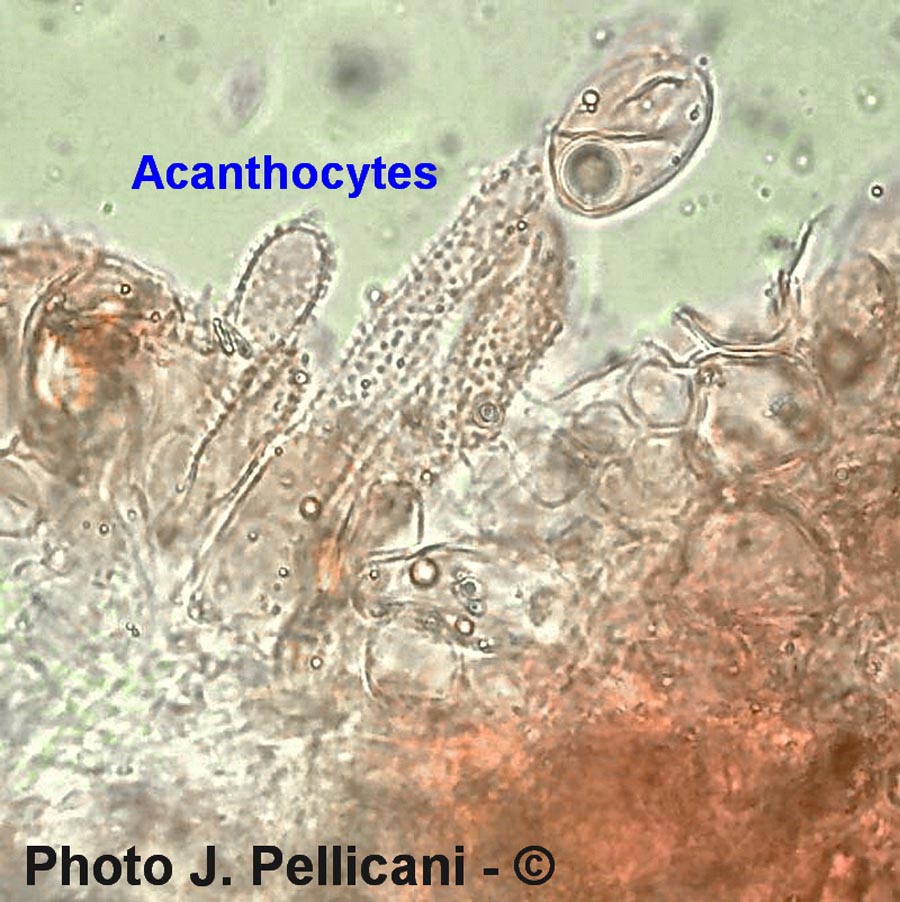 Acanthophyse