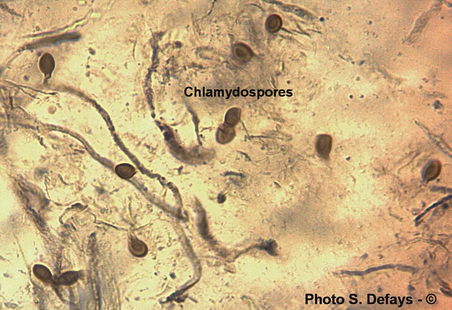 Chlamydospore