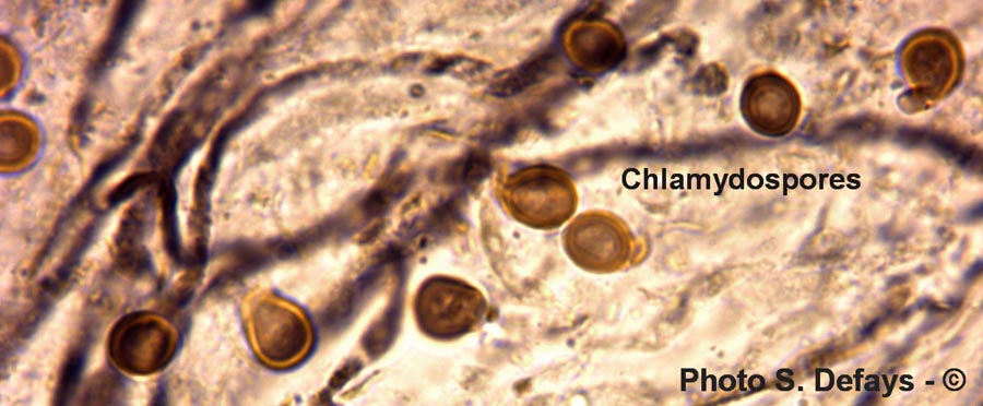 Chlamydospore