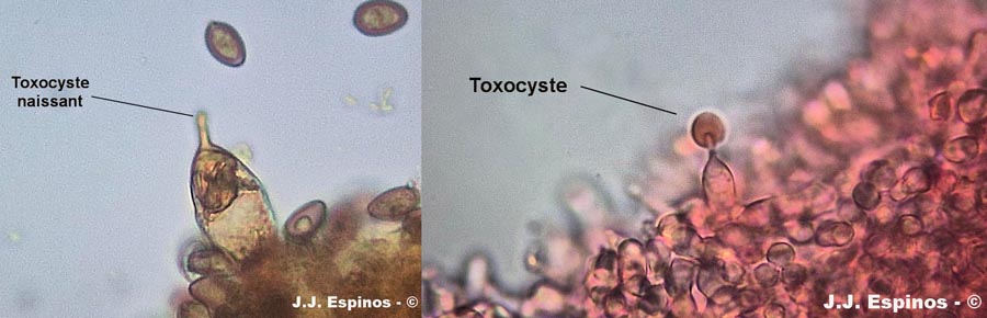 Toxocyste
