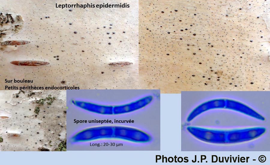 Leptorrhaphis epidermidis