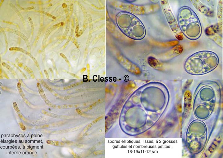 Octospora humosa
