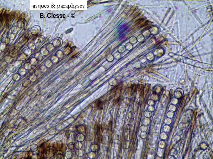 Pseudoplectania nigrella