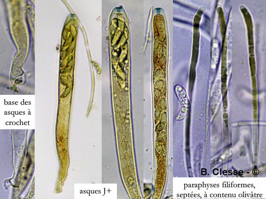 Rutstroemia echinophila