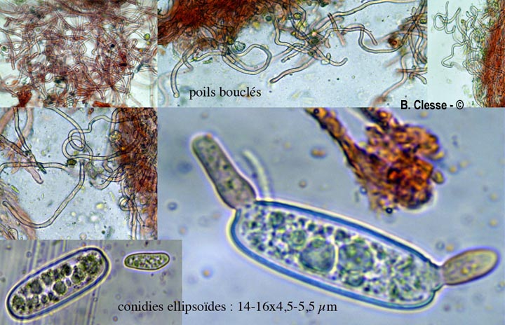 Sarcoscypha austriaca
