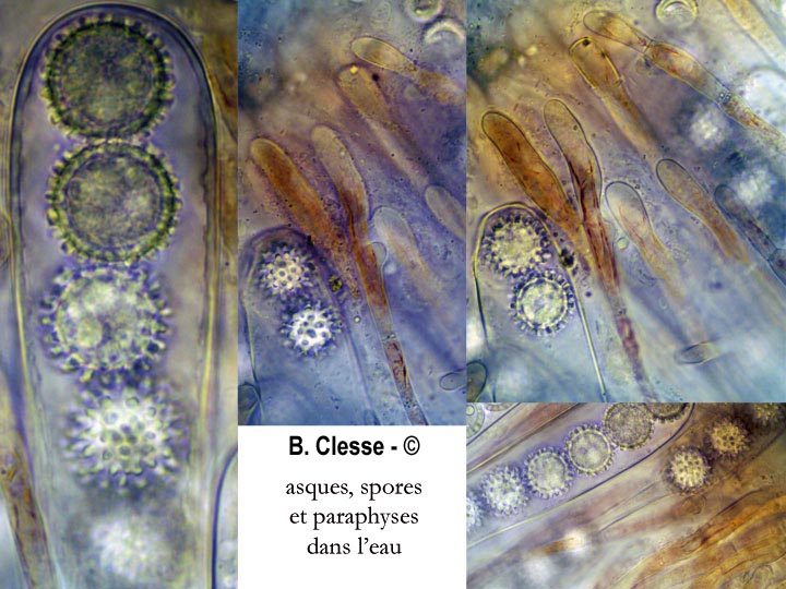 Scutellinia trechispora
