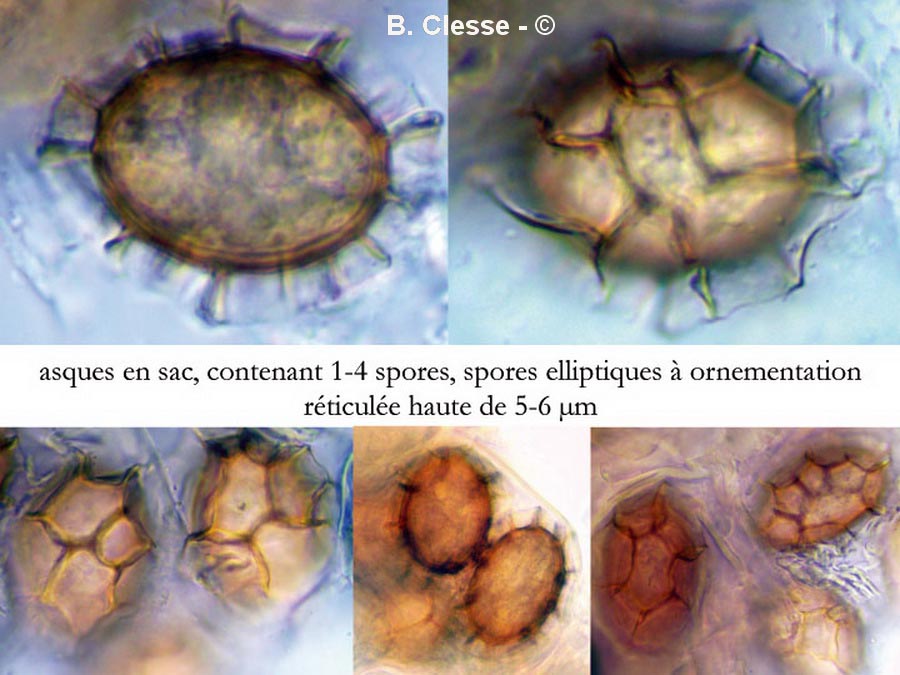 Tuber excavatum