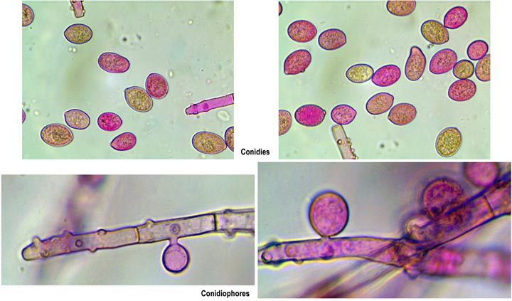 Botryobasidium conspersum