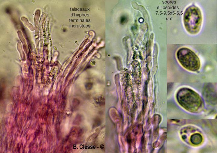 Hyphodermella corrugata