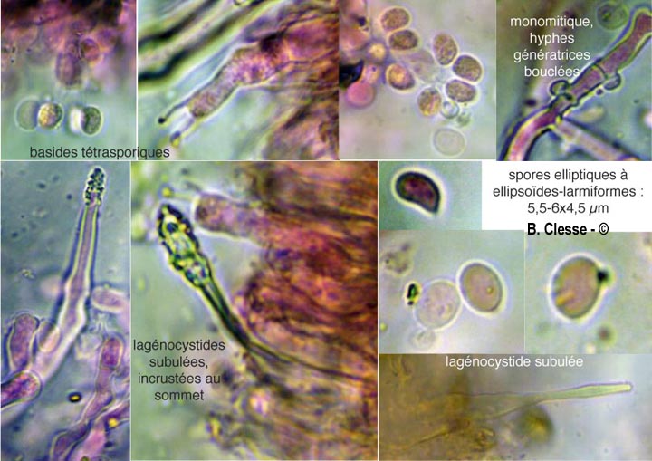 Hyphodontia alutaria