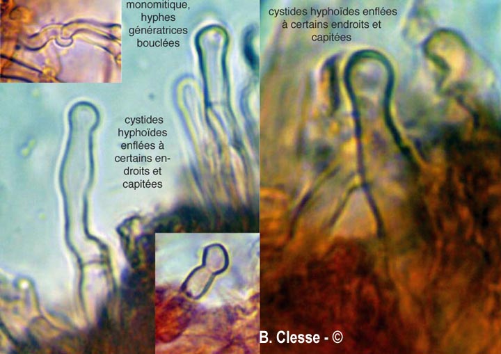 Hyphodontia arguta