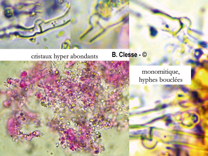 Lyomyces sambuci (Xylodon sambuci, Rogersella sambuci)