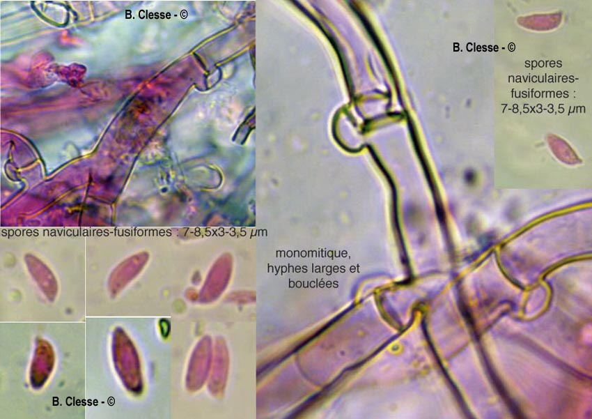 Botryobasidium subcoronatum