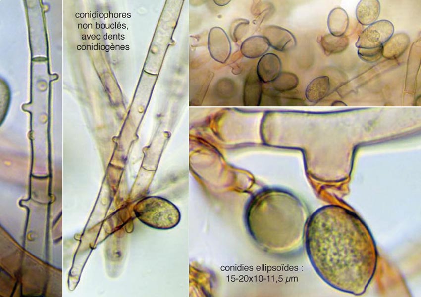 Botryobasidium conspersum