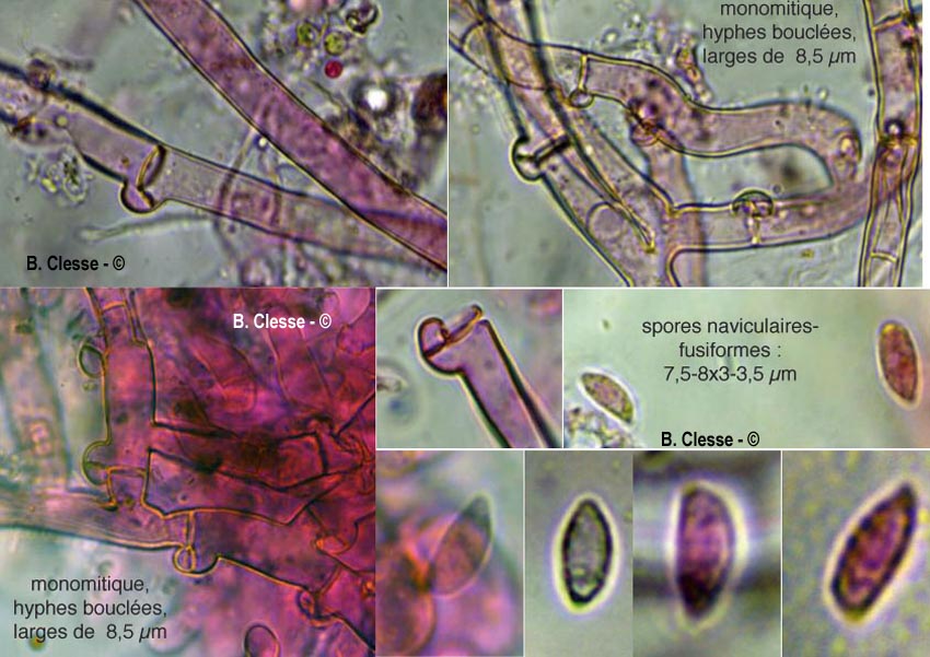 Botryobasidium subcoronatum