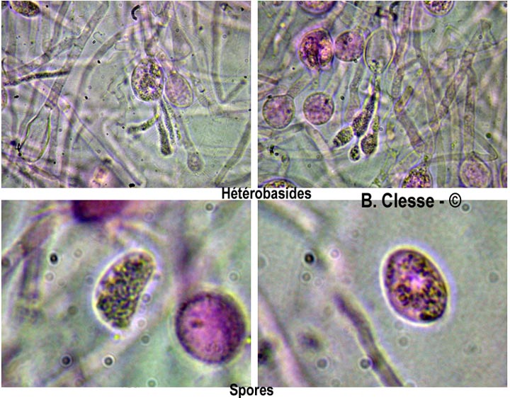 Sebacina epigaea