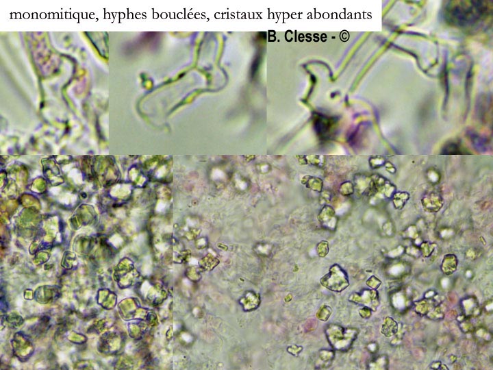 Sistotrema brinkmannii