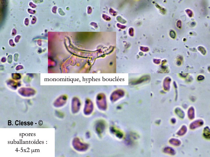 Sistotrema brinkmannii
