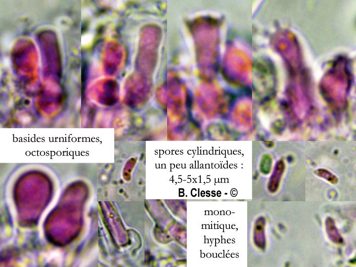Sistotrema oblongisporum