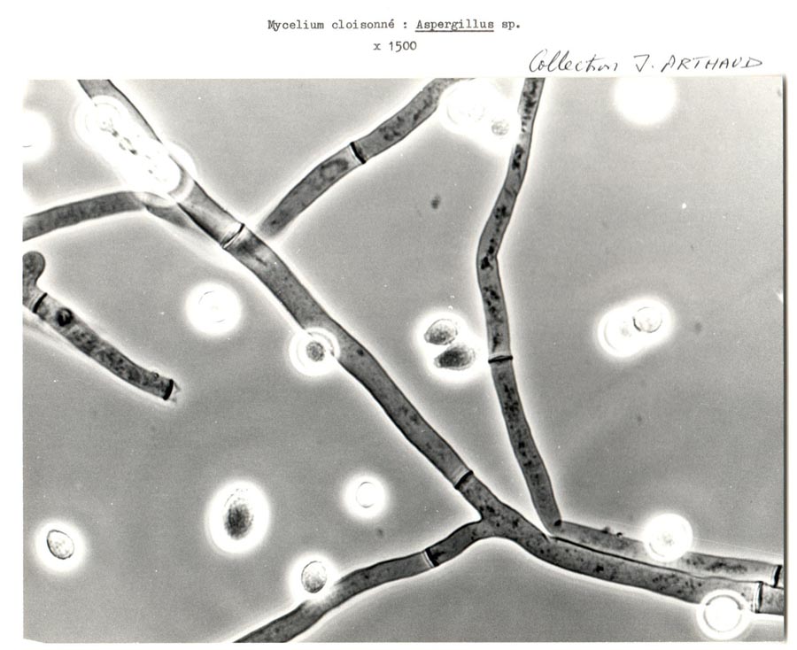 Aspergillus sp.