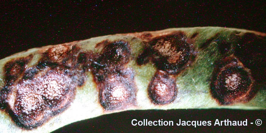 Colletotrichum lindemuthianum
