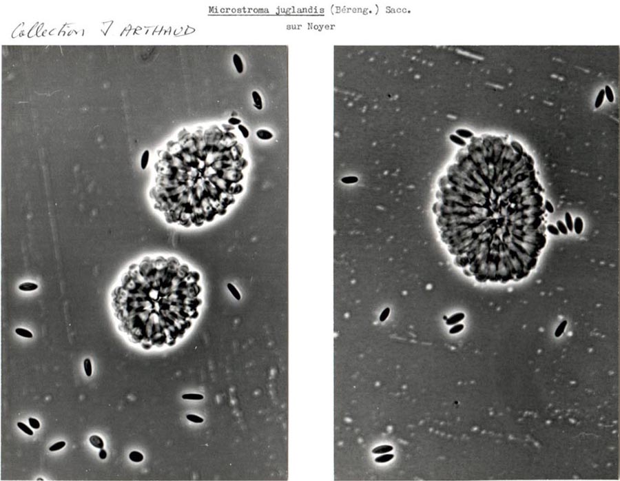 Microstroma juglandis