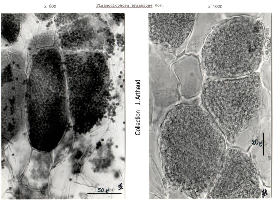 Plasmodiophora brassicae