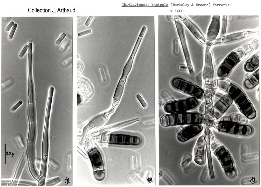 Thielaviopsis basicola (Chalara elegans)