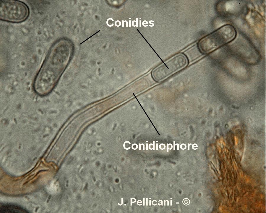 Ceratocystis paradoxa (Chalaropsis thielavioides)