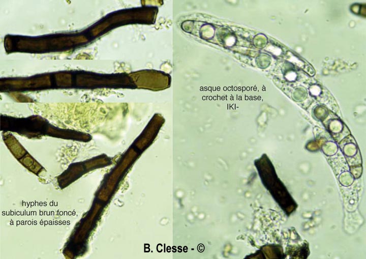 Chaetosphaerella phaeostroma