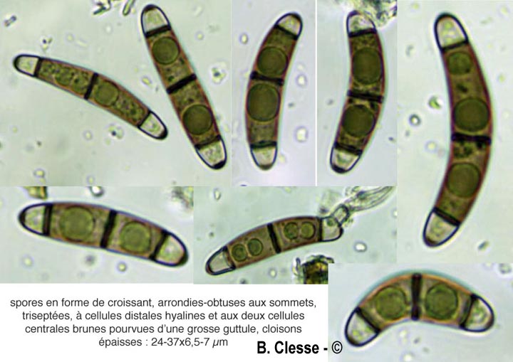 Chaetosphaerella phaeostroma