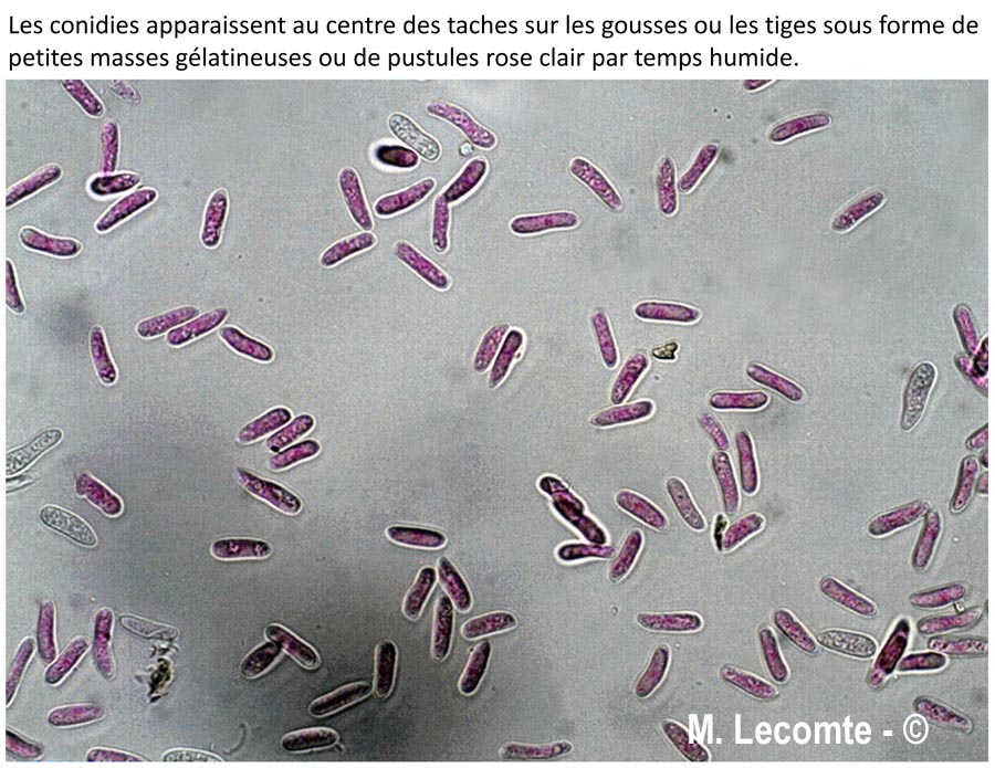 Colletotrichum lindemuthianum