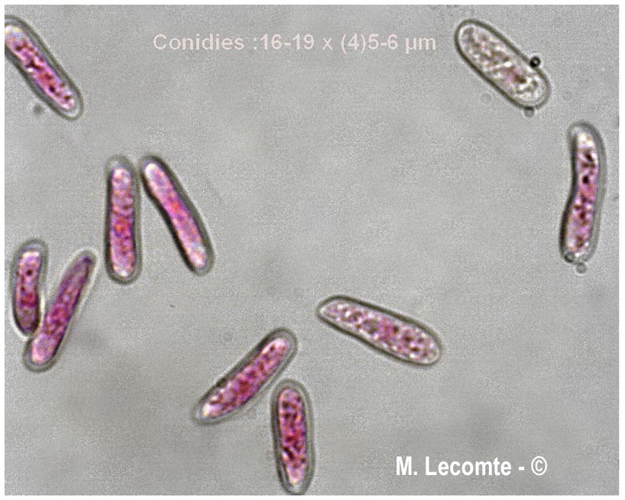 Colletotrichum lindemuthianum