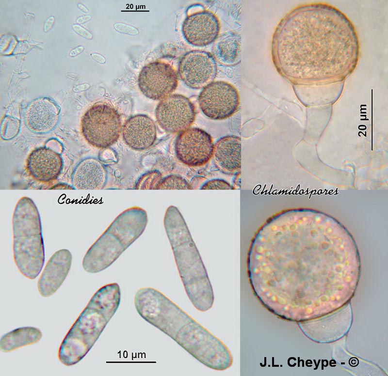 Mycogone rosea