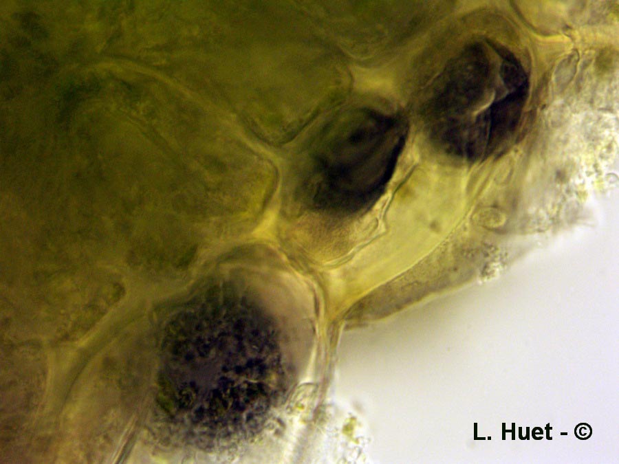 Mycosphaerella polygoni-cuspidati