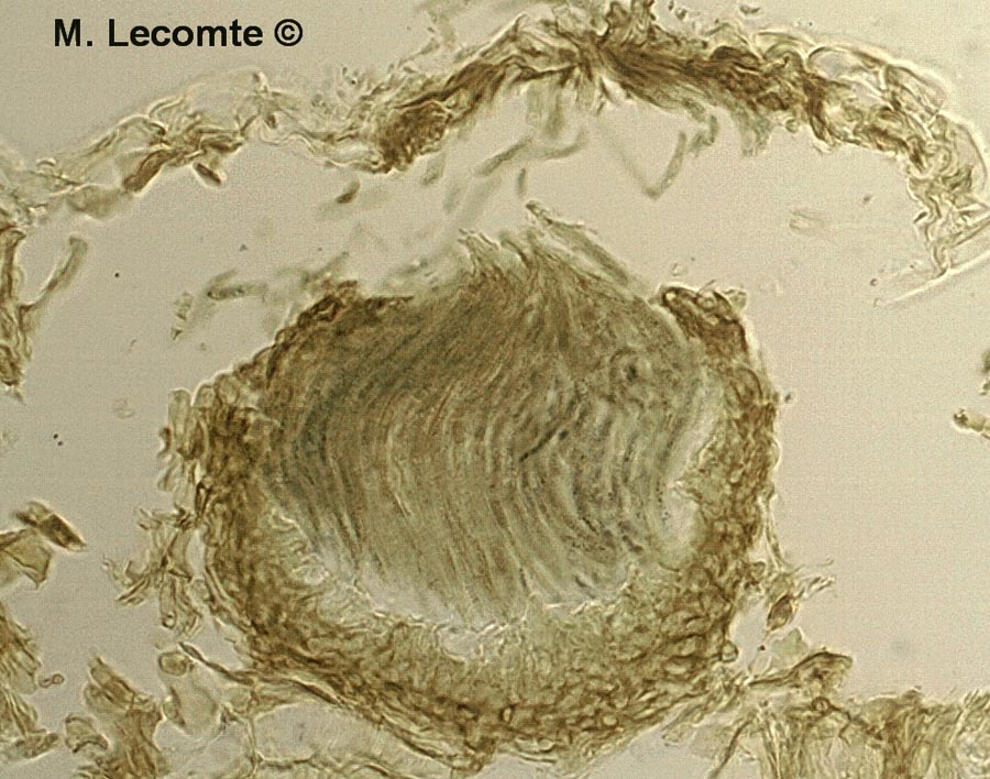 Septoria pinicola