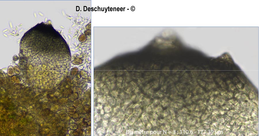 Sphaerellopsis filum