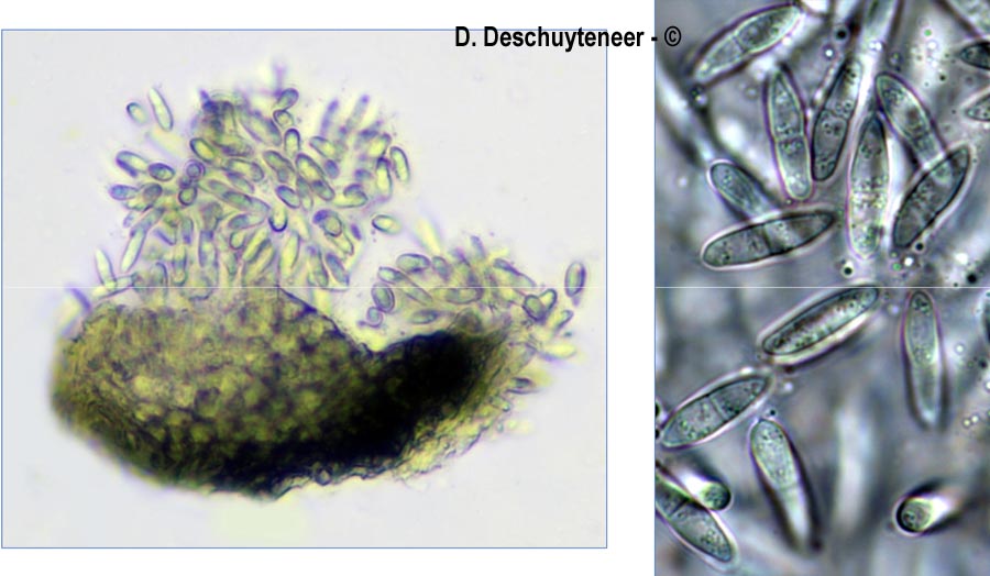Sphaerellopsis filum