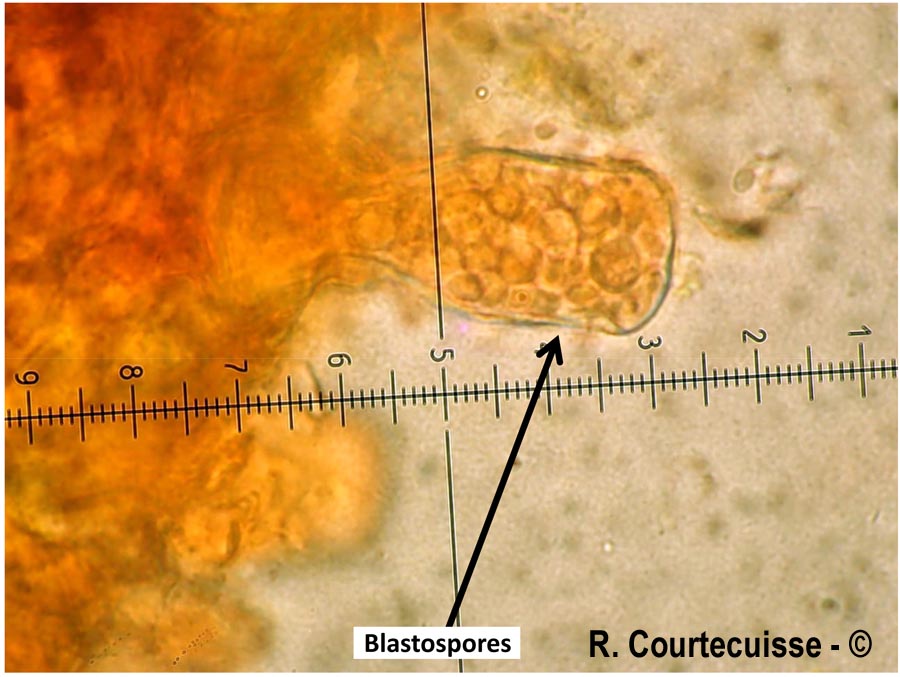 Taphrina alni
