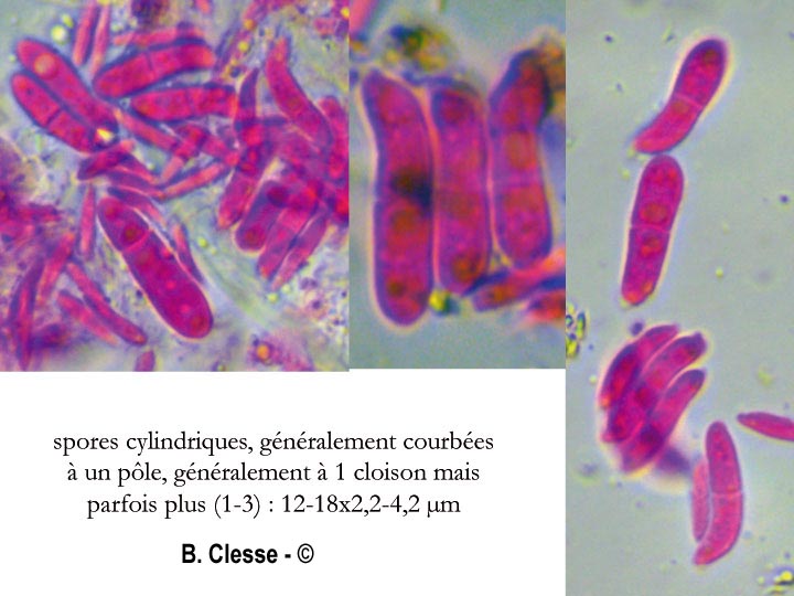Exobasidium karstenii
