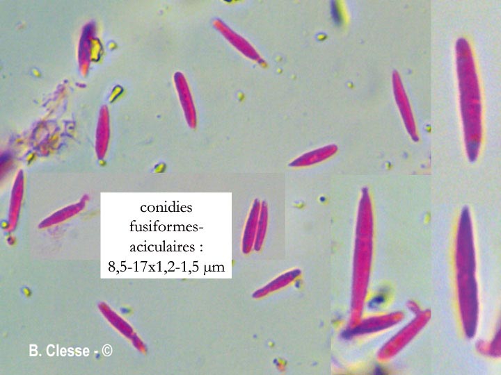 Exobasidium karstenii