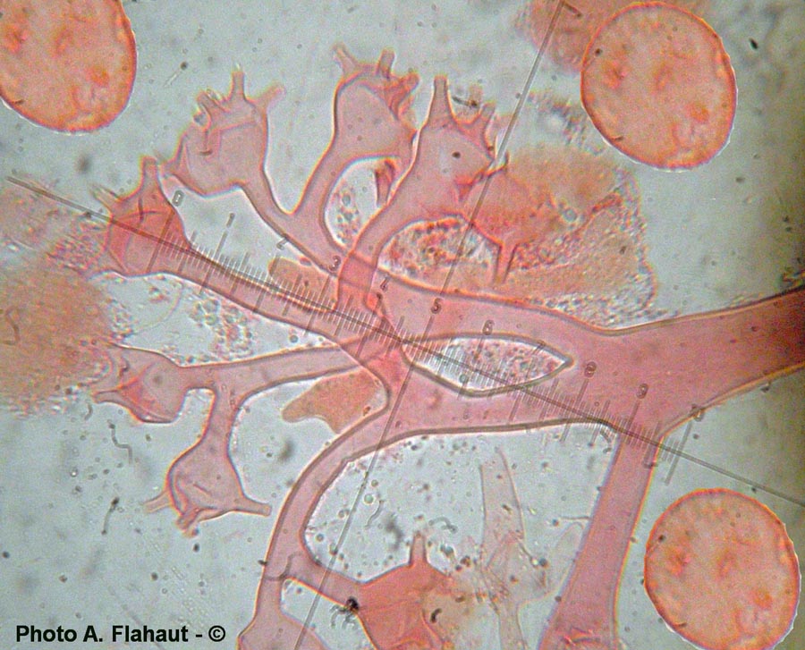 Bremia sonchi