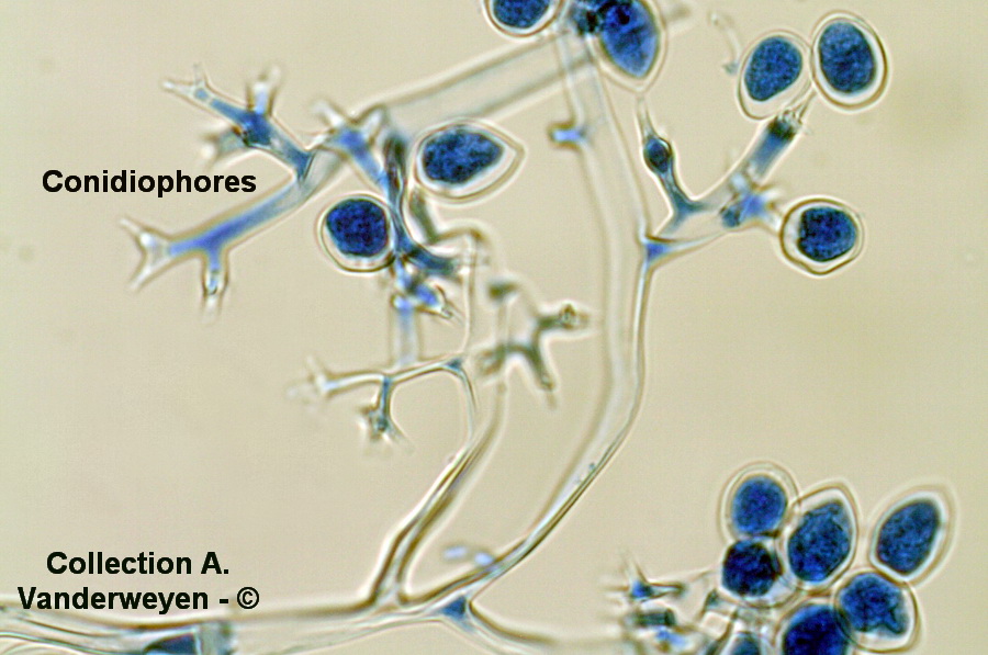 Plasmopara viticola