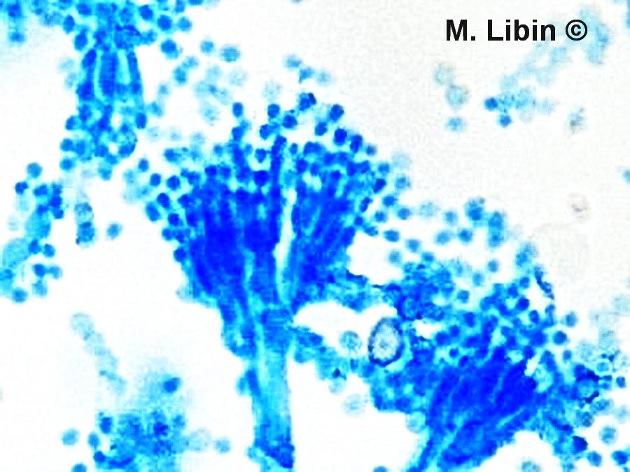 Penicillium roquefortii