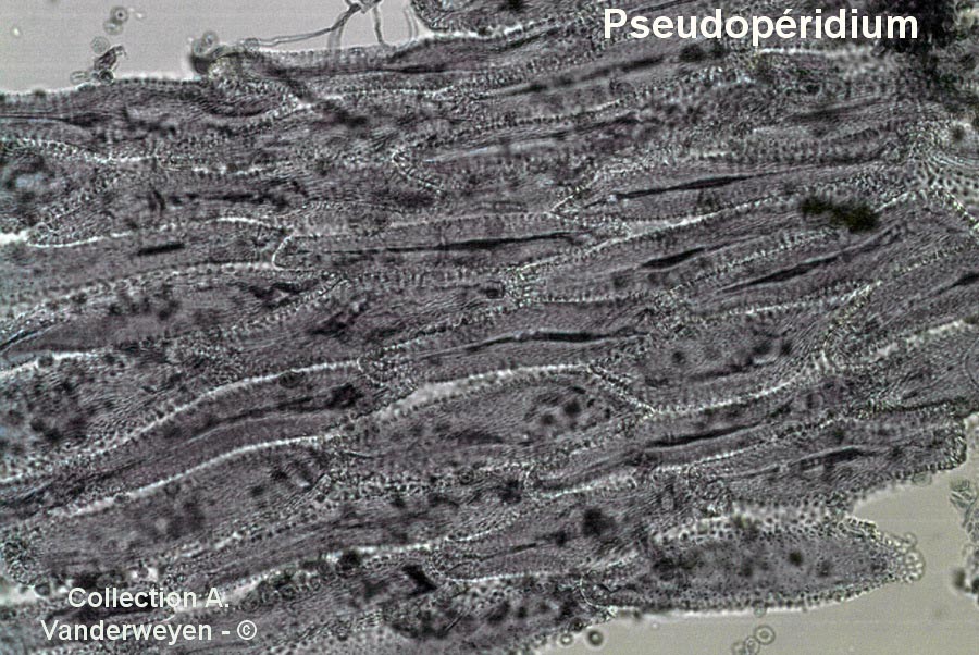 Gymnosporangium clavariiforme