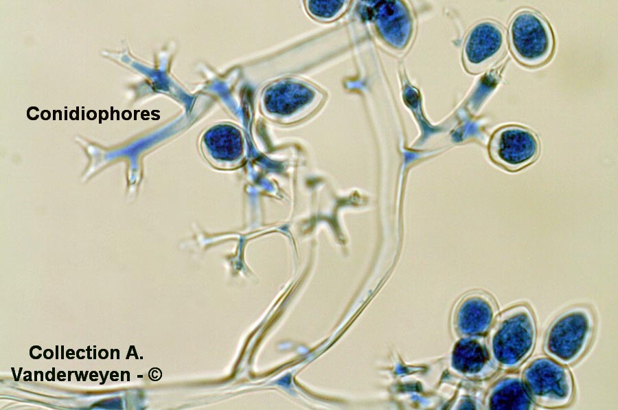 Plasmopara viticola