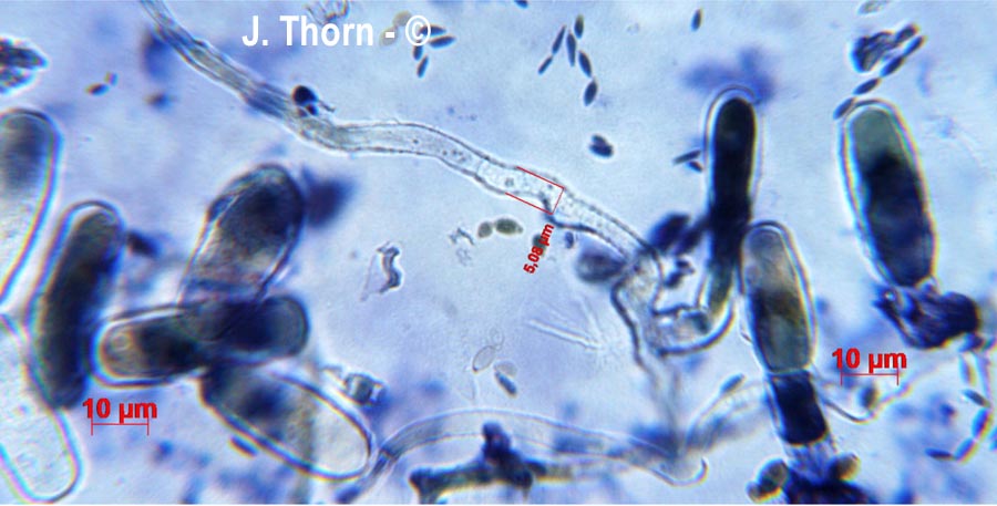 Erysiphe euonymicola