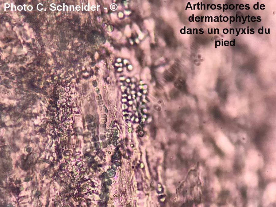 Arthrospores de dermatophytes