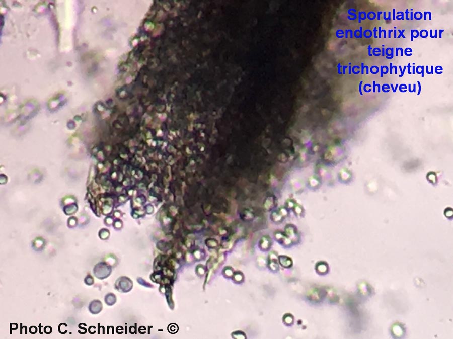 Sporulation endothrix pour teigne trichophytique